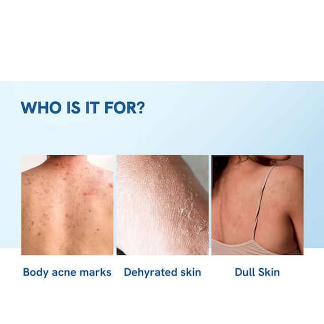 BE BODYWISE 10%NIACINAMIDE BODY LOTION ACNE